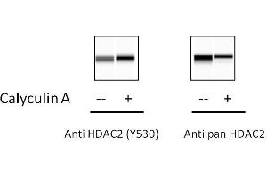 HeLa cells were treated or untreated with Calyculin A. (HDAC2 ELISA Kit)