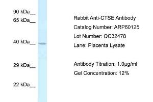 Western Blotting (WB) image for anti-Cathepsin E (CTSE) (C-Term) antibody (ABIN2788343) (Cathepsin E antibody  (C-Term))