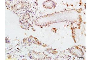 Immunohistochemistry (Paraffin-embedded Sections) (IHC (p)) image for anti-CD248 Molecule, Endosialin (CD248) (AA 251-350) antibody (ABIN677573)
