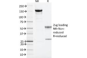 SDS-PAGE Analysis Purified ARF1 Mouse Monoclonal Antibody (1A9/5).