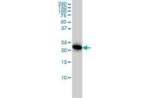 AK1 monoclonal antibody (M06), clone 3A6-1F5 Western Blot analysis of AK1 expression in HeLa . (Adenylate Kinase 1 antibody  (AA 1-194))