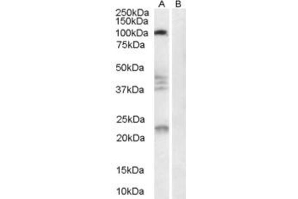 ATP6V0E2 antibody  (N-Term)