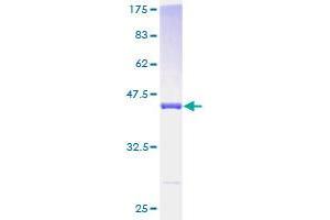 PDE6D Protein (AA 1-150) (GST tag)