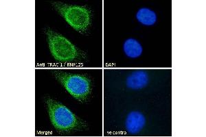 ABIN185241 Immunofluorescence analysis of paraformaldehyde fixed HeLa cells, permeabilized with 0. (RNF125 antibody  (C-Term))