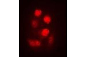 Immunofluorescent analysis of SEN2 staining in A549 cells. (TSEN2 antibody)