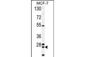 NUDT8 Antibody (N-term) (ABIN654517 and ABIN2844241) western blot analysis in MCF-7 cell line lysates (35 μg/lane).
