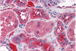 Immunohistochemistry (IHC) image for anti-Potassium Intermediate/small Conductance Calcium-Activated Channel, Subfamily N, Member 2 (KCNN2) (Internal Region) antibody (ABIN571061)