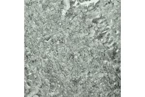 IHC on mouse brain (cryo section) using Rabbit antibody to Synaptotagmin 17  at a concentration of 50 µg/ml incubated overnight at 4C. (SYT17 antibody  (Internal Region))