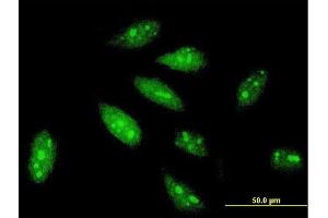 Immunofluorescence of monoclonal antibody to TRIM56 on HeLa cell. (TRIM56 antibody  (AA 656-755))
