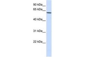 Image no. 1 for anti-Forkhead Box O4 (FOXO4) (AA 108-157) antibody (ABIN6744334) (FOXO4 antibody  (AA 108-157))