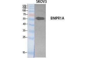 Western Blotting (WB) image for anti-Bone Morphogenetic Protein Receptor 1A (BMPR1A) (Internal Region) antibody (ABIN3178544) (BMPR1A antibody  (Internal Region))