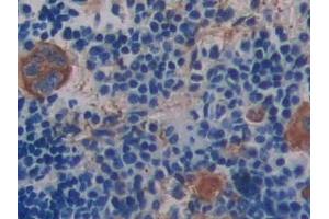 Detection of ITGb3 in Mouse Spleen Tissue using Polyclonal Antibody to Integrin Beta 3 (ITGb3) (Integrin beta 3 antibody  (AA 134-376))