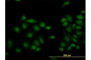 Image no. 1 for anti-Lysine (K)-Specific Demethylase 5B (KDM5B) (AA 231-320) antibody (ABIN599151) (KDM5B antibody  (AA 231-320))