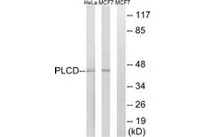 Western Blotting (WB) image for anti-1-Acylglycerol-3-Phosphate O-Acyltransferase 4 (AGPAT4) (AA 151-200) antibody (ABIN2890034) (AGPAT4 antibody  (AA 151-200))