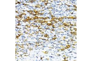 Immunohistochemistry of paraffin-embedded human tonsil using SNRNP70 antibody. (SNRNP70 antibody  (AA 150-250))