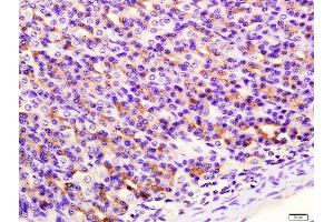 Paraformaldehyde-fixed, paraffin embedded rat stomach tissue, Antigen retrieval by boiling in sodium citrate buffer(pH6) for 15min, Block endogenous peroxidase by 3% hydrogen peroxide for 30 minutes, Blocking buffer (normal goat serum) at 37°C for 20min, Antibody incubation with Rabbit Anti-SIRT4 Polyclonal Antibody, Unconjugated  at 1:400 overnight at 4°C, followed by a conjugated secondary and DAB staining (SIRT4 antibody  (AA 51-150))