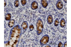 Immunostaining (ISt) image for anti-Solute Carrier Family 9, Subfamily A (NHE3, Cation Proton Antiporter 3), Member 3 Regulator 1 (SLC9A3R1) (AA 252-358) antibody (ABIN522831)