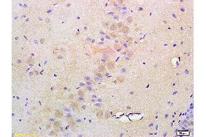 Formalin-fixed and paraffin embedded rat brain labeled with Anti-ATF6 Polyclonal Antibody, Unconjugated (ABIN732293) at 1:200 followed by conjugation to the secondary antibody and DAB staining (ATF6 antibody  (AA 301-400))