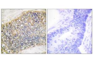 Immunohistochemistry analysis of paraffin-embedded human colon carcinoma tissue using TALL-2 antibody.