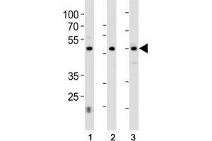HNF4A antibody western blot analysis in 1) 293, 2) HepG2 cell line and 3) rat liver tissue lysate. (HNF4A antibody  (AA 281-312))