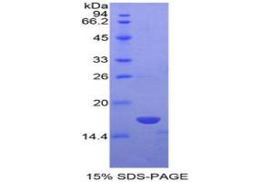 SDS-PAGE analysis of Human NME4 Protein. (Non Metastatic Cells 4, Protein NM23A Expressed In Protein)