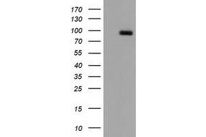 Western Blotting (WB) image for anti-CUB Domain Containing Protein 1 (CDCP1) antibody (ABIN1497413) (CDCP1 antibody)