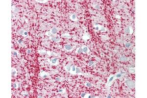Anti-TPPP antibody IHC staining of human brain, cortex. (Tppp antibody  (AA 21-35))