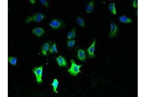 Immunofluorescent analysis of A549 cells using ABIN7146318 at dilution of 1:100 and Alexa Fluor 488-congugated AffiniPure Goat Anti-Rabbit IgG(H+L) (CCDC109B antibody  (Regulatory Subunit))