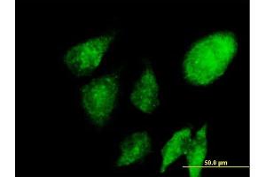Immunofluorescence of purified MaxPab antibody to NACA on HeLa cell. (NACA antibody  (AA 1-215))