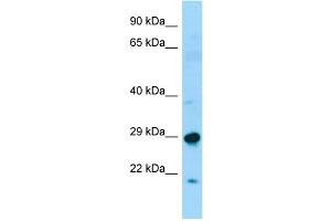 WB Suggested Anti-SPAG7 Antibody Titration: 1. (SPAG7 antibody  (N-Term))