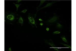 Immunofluorescence (IF) image for anti-Septin 8 (SEPT8) (AA 1-258) antibody (ABIN1326930)