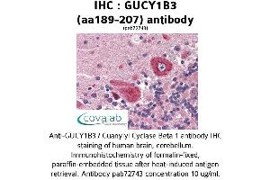 Image no. 1 for anti-Guanylate Cyclase 1, Soluble, beta 3 (GUCY1B3) (AA 189-207) antibody (ABIN2852385) (GUCY1B3 antibody  (AA 189-207))
