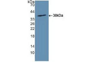 Figure1. (Glutaminase antibody  (AA 221-533))