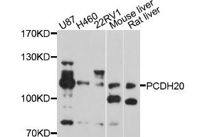 Western blot analysis of extracts of various cell lines, using PCDH20 antibody (ABIN5998470) at 1/1000 dilution.