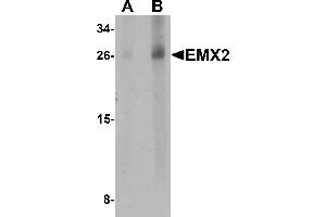 Western blot analysis of EMX2 in human lung tissue lysate with EMX2 antibody at (A) 1 and (B) 2 µg/mL. (EMX2 antibody  (Middle Region))