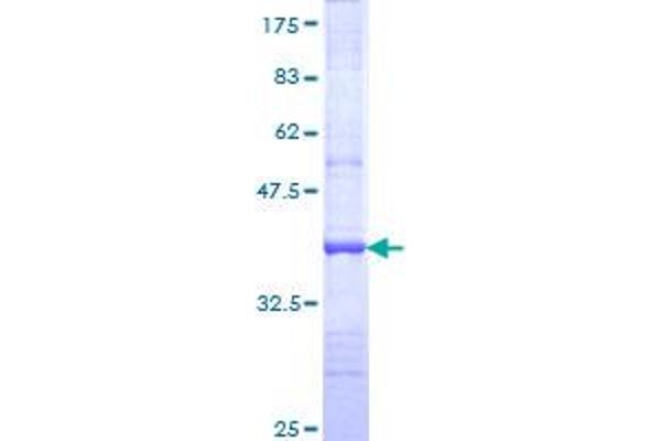 JAK1 Protein (AA 221-320) (GST tag)