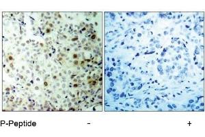 Image no. 1 for anti-Cyclin-Dependent Kinase 2 (CDK2) (pThr160) antibody (ABIN196844) (CDK2 antibody  (pThr160))