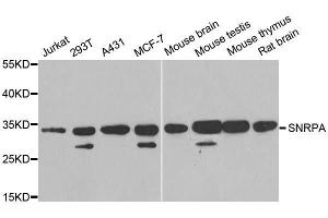 Western Blotting (WB) image for anti-Small Nuclear Ribonucleoprotein Polypeptide A (SNRPA) (AA 1-282) antibody (ABIN6148210)