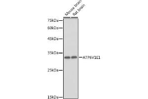 Western blot analysis of extracts of various cell lines, using V1E1 antibody (ABIN1678795, ABIN3018056, ABIN3018057 and ABIN6220346) at 1:1000 dilution. (ATP6V1E1 antibody  (AA 77-226))