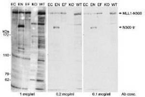 Image no. 1 for anti-Lysine (K)-Specific Methyltransferase 2A (KMT2A) (AA 720-780), (N-Term) antibody (ABIN328575) (Lysine (K)-Specific Methyltransferase 2A (KMT2A) (AA 720-780), (N-Term) antibody)