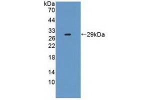 Detection of Recombinant IL2Ra, Human using Polyclonal Antibody to Interleukin 2 Receptor Alpha (IL2Ra) (CD25 antibody  (AA 22-213))