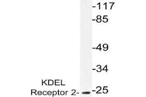 Western blot (WB) analysis of KDEL Receptor 2 antibody in extracts from HUVEC cells.