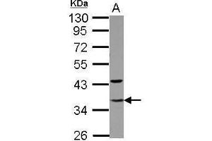 GTF2E2 antibody