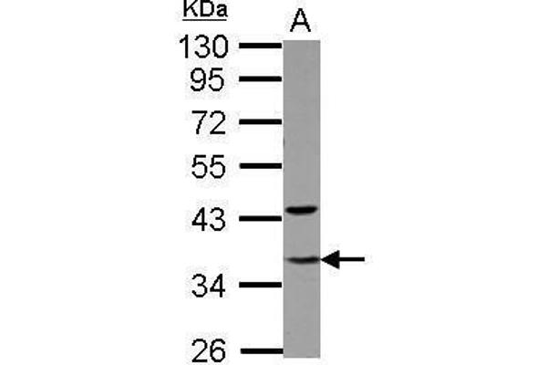 GTF2E2 antibody