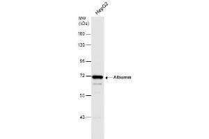WB Image Whole cell extract (30 μg) was separated by 7. (Albumin antibody  (C-Term))