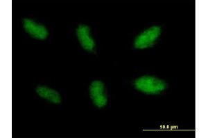 Immunofluorescence of purified MaxPab antibody to NHEJ1 on HepG2 cell. (NHEJ1 antibody  (AA 1-299))