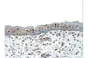 NR2C2 antibody was used for immunohistochemistry at a concentration of 4-8 ug/ml. (TR4 antibody  (C-Term))