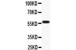 Anti-TdT Picoband antibody,  All lanes: Anti TDT  at 0. (TdT antibody  (AA 316-509))