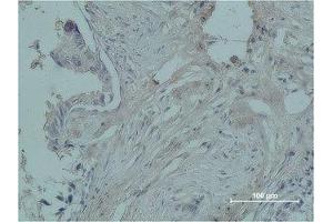 Immunohistochemistry (IHC) image for anti-PR antibody (ABIN3181500) (PR antibody)