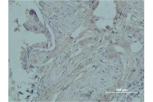 Immunohistochemistry (IHC) image for anti-PR antibody (ABIN3179014) (PR antibody)